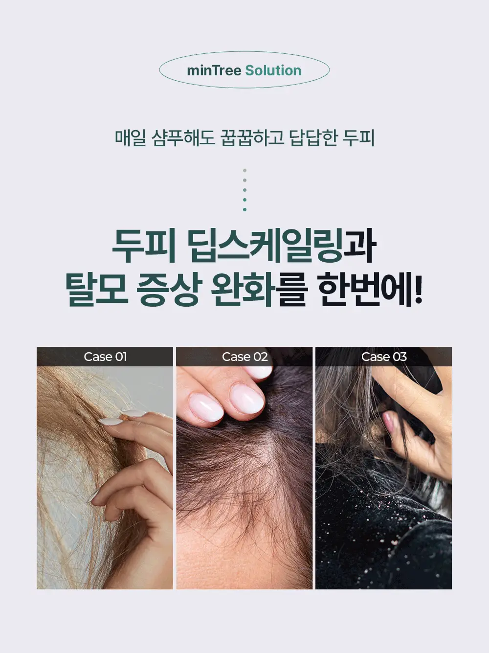 [두피치약] 민트리 탄산버블 두피 스케일러 75g (15gx5ea) 상세페이지 3